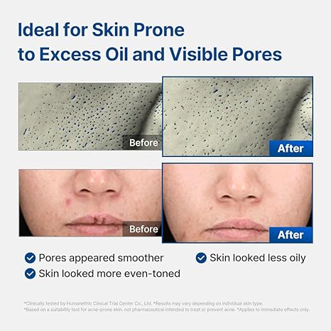 Cellology Blue Eraser Serum [1 set]